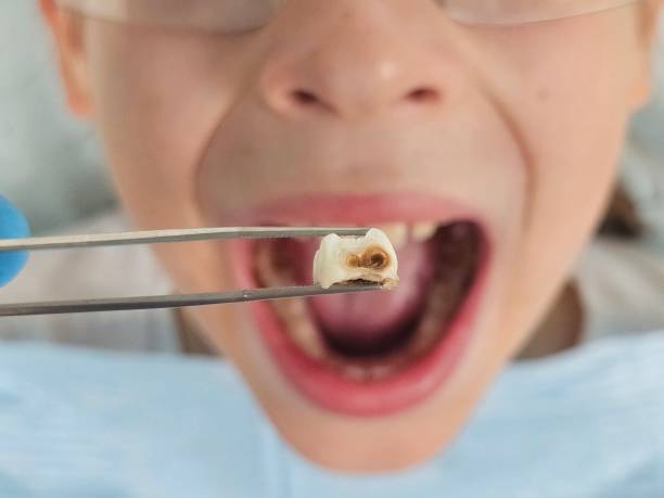 Best Weekend Emergency Dentist in Wharton, TX