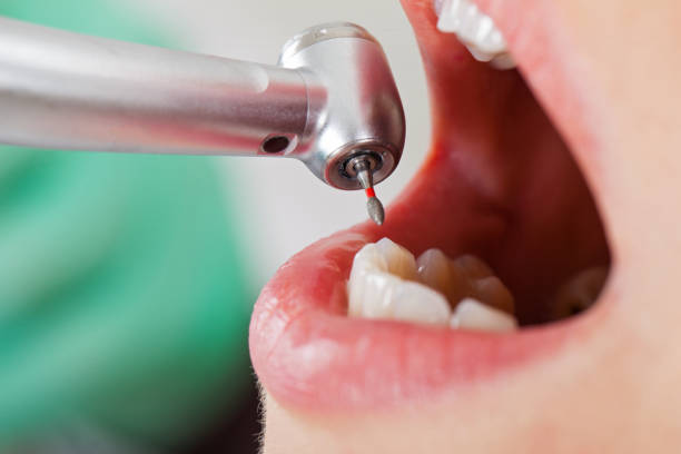 Best Emergency Root Canal Treatment in Wharton, TX